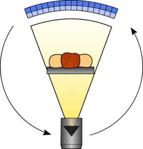 Schematische Darstellung des Funktionsprinzips eines Computertomographen der dritten Generation: Die Röntgenröhre und die Detektoren rotieren um den Patienten, während dieser auf dem Tisch langsam durch die Gantry geschoben wird.