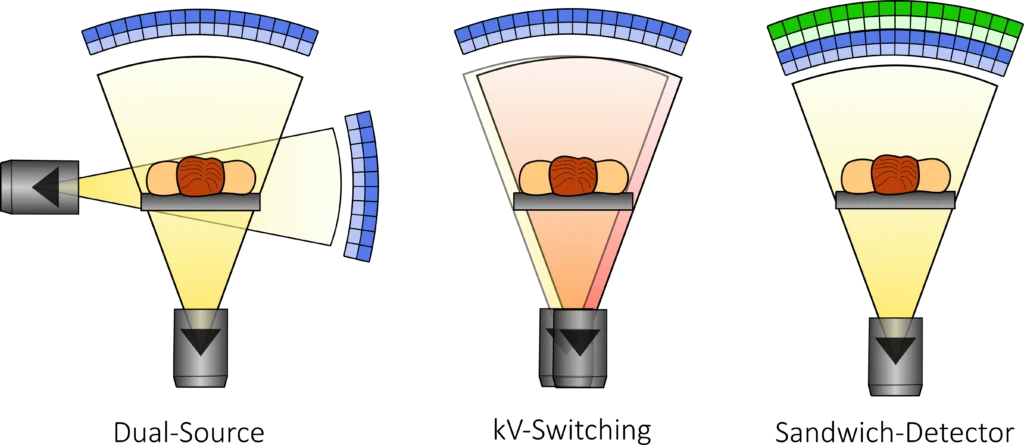 computertomographie dual source ct typenpng