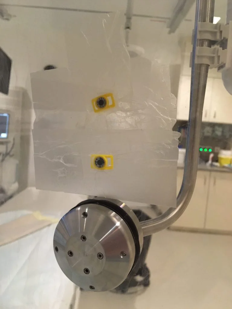 augenlinsendosimetrie worst case messung im herzkatheterlabor