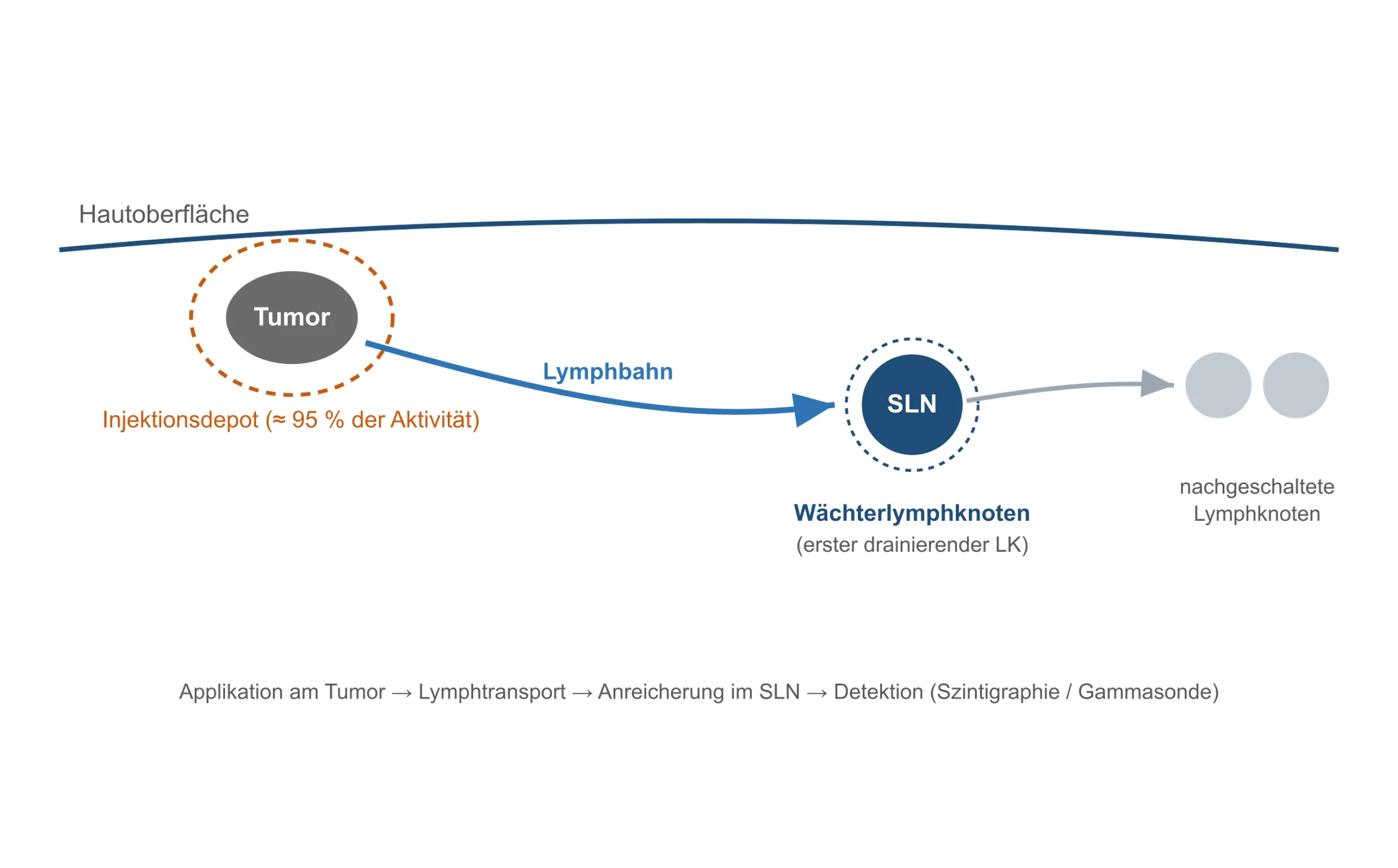 sln diagnostik schema