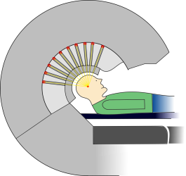 Schematische Darstellung des Gamma-Knife Modells U