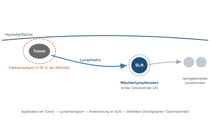 sln diagnostik schema