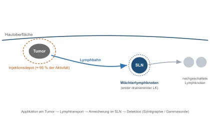 sln diagnostik schema